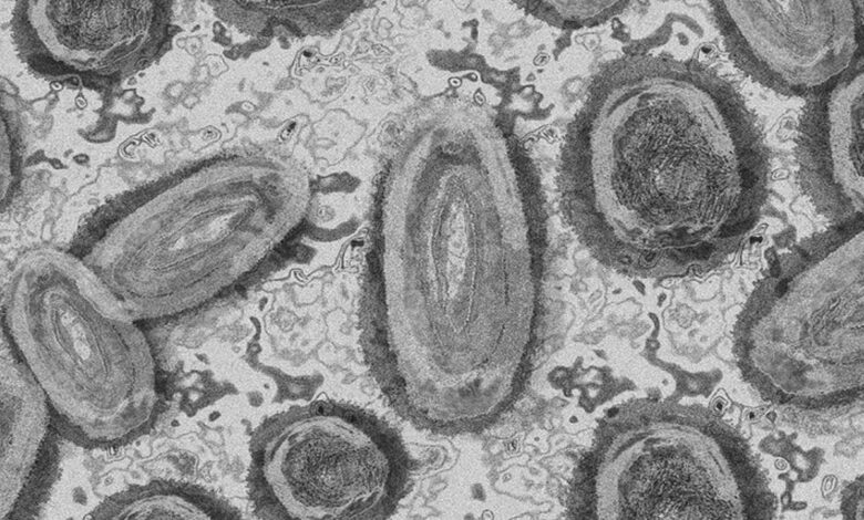 Virus-cacar-monyet