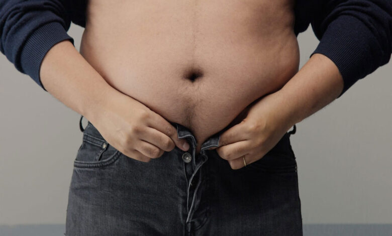Obesitas
