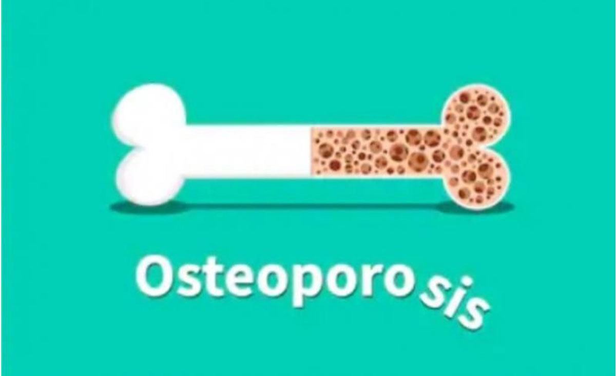 indoposco