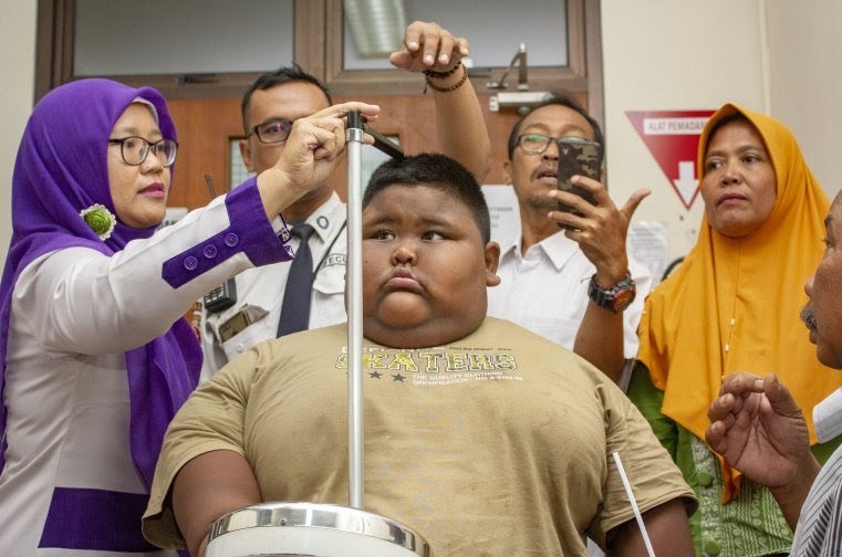 Seorang anak mengalami kegemukan. Foto : Antara