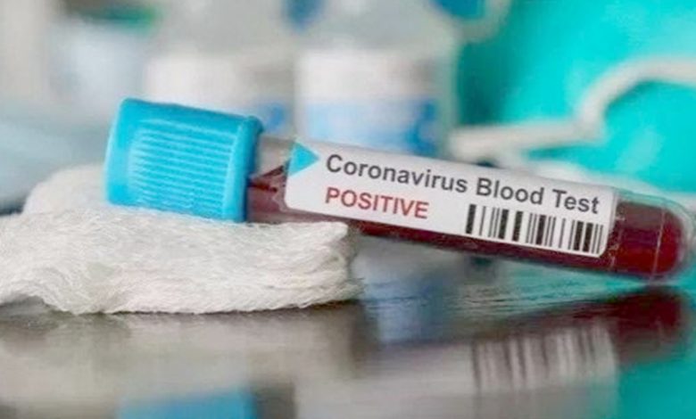 Sampel darah yang terindikasi positif virus corona