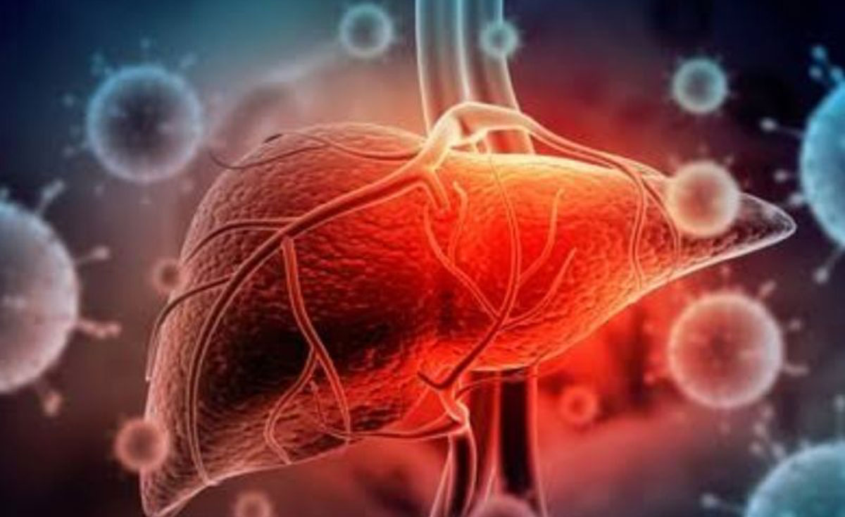 Hepatitis Akut