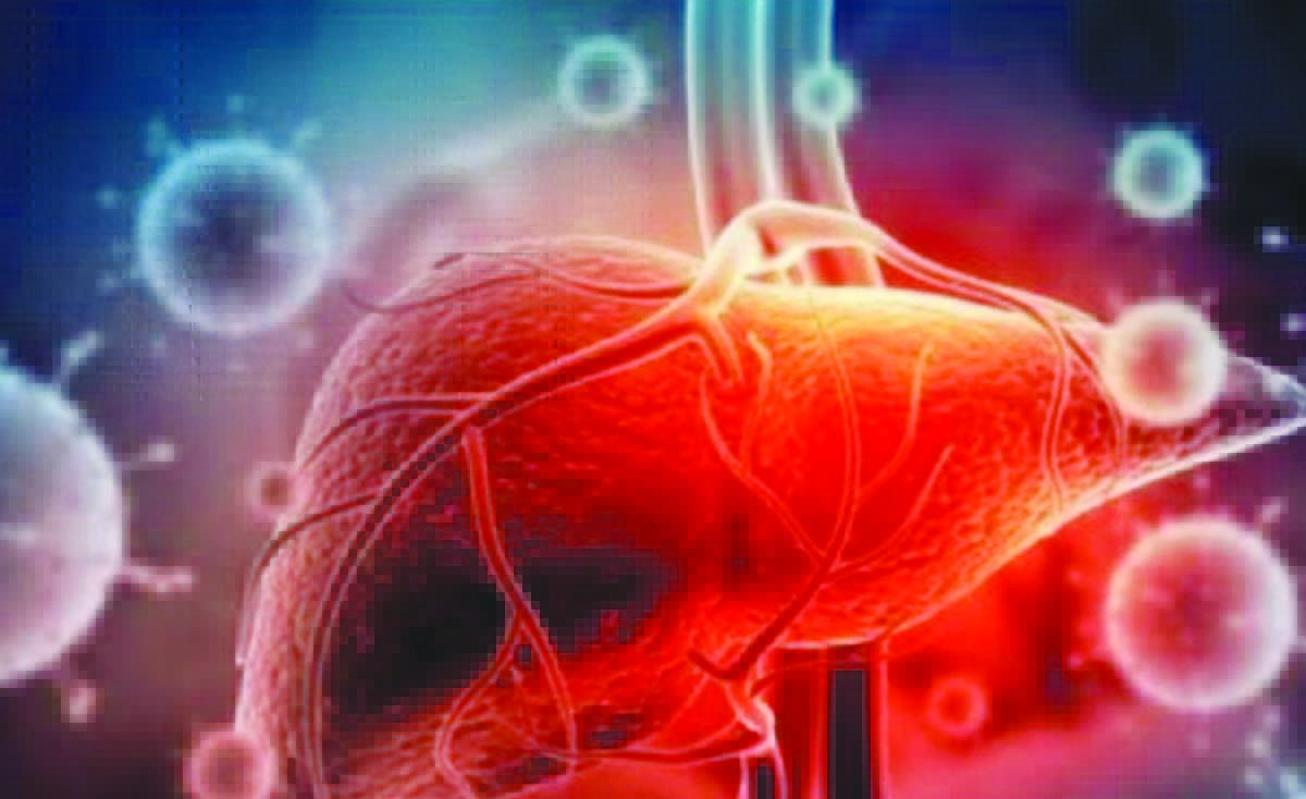 hepatitiss