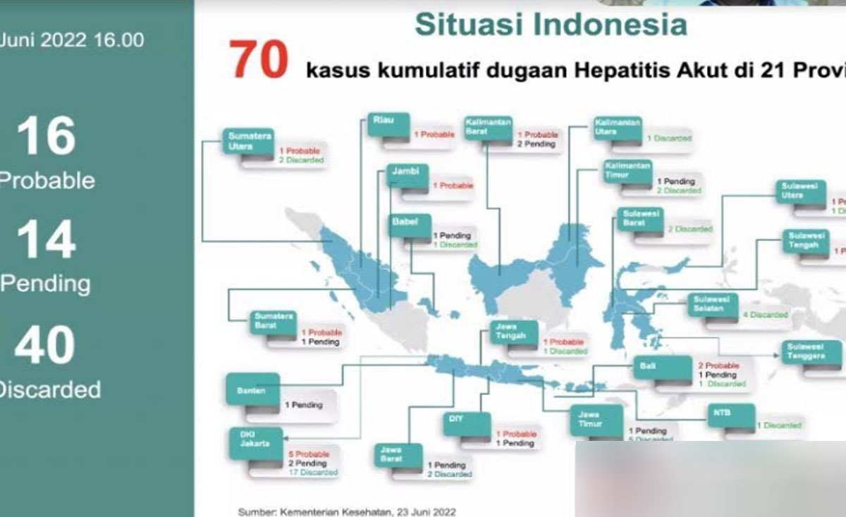 Hepatitis Akut Misterius Di Indonesia Sudah Capai 70 Kasus Indoposco   Diagram Hepatitis Akut 