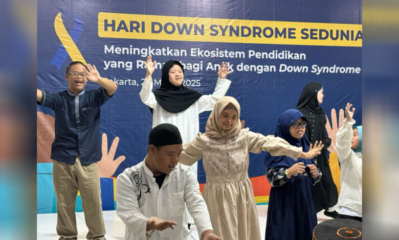 Anak-Down-Syndrome