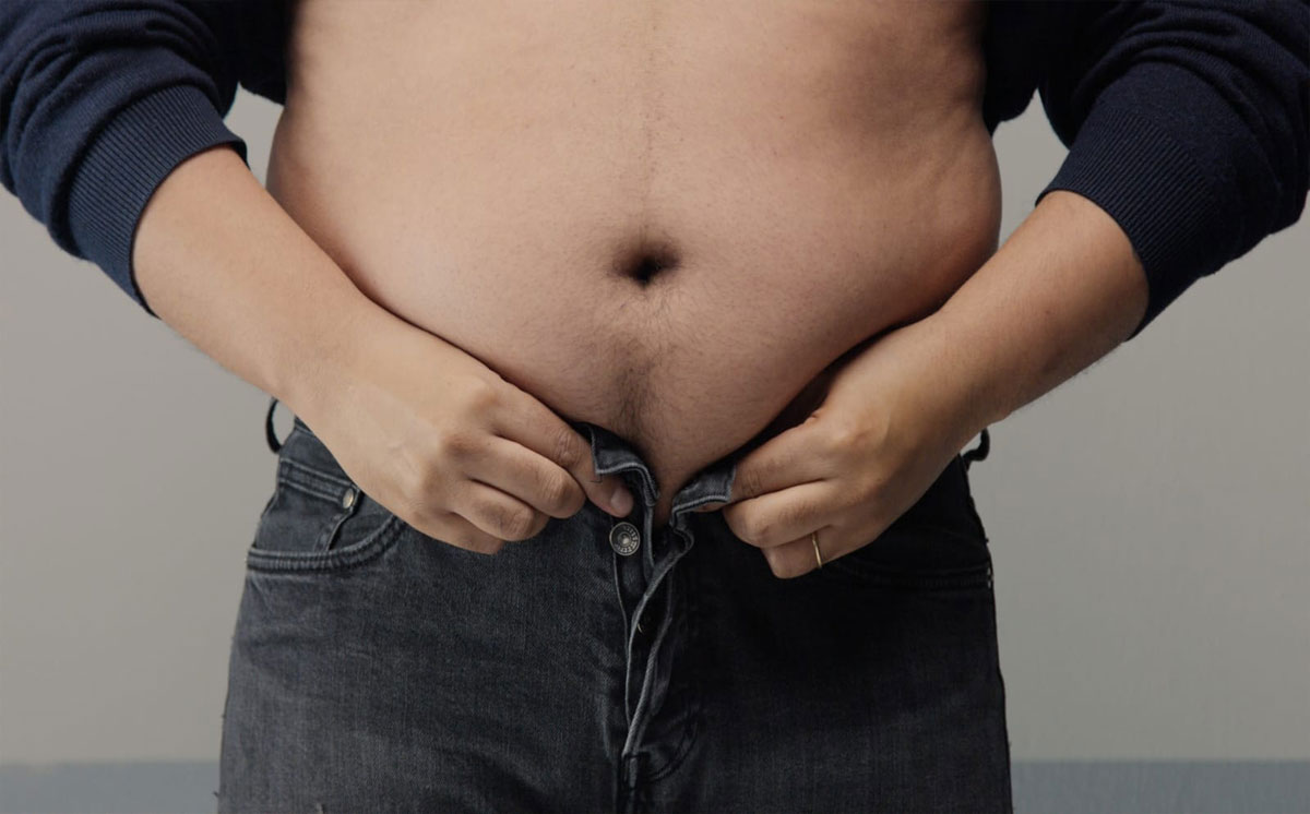 Obesitas