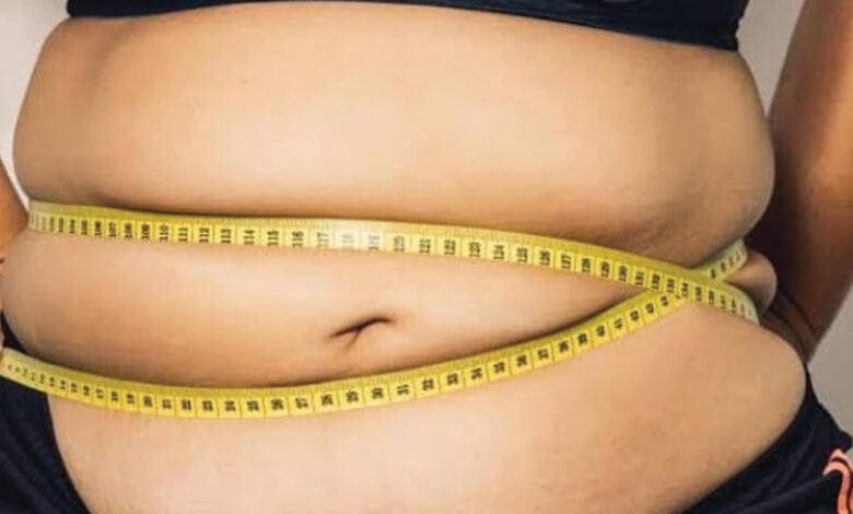 obesitas